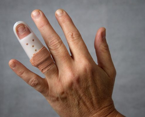 fingerfracture 1280