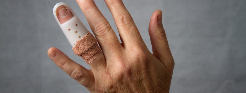 ¿Cuánto paga la ART por fractura de dedo?