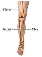 fractura tibia y perone