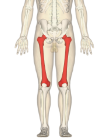 fractura femur art