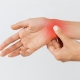 sindrome tunel carpiano