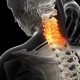 Cervicobraquialgia