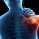 omalgia